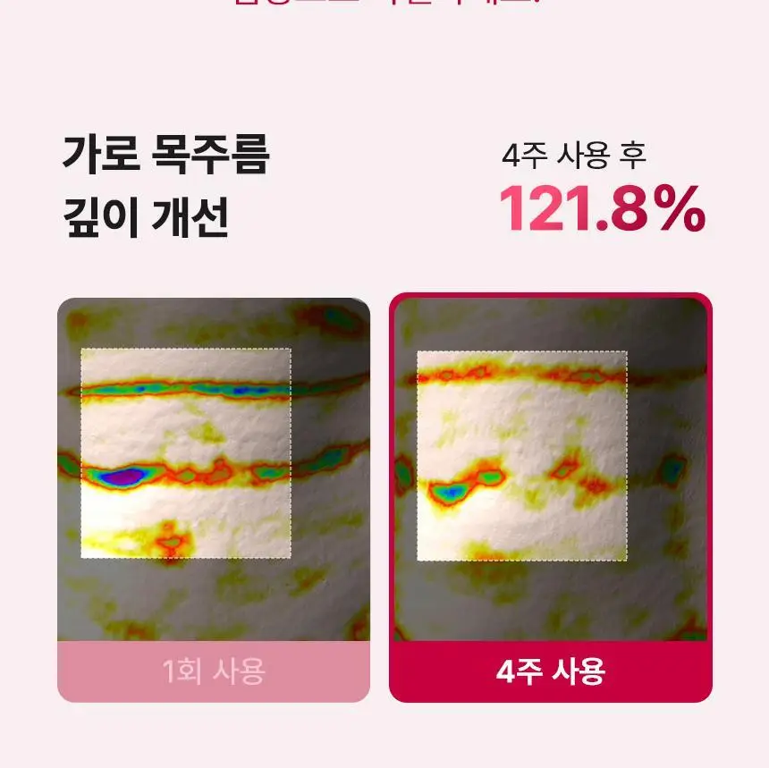 [줄기세포 넥패치/목주름] 뷰앤디 넥실키 마스크 (1매입/5매입) 상세페이지 21